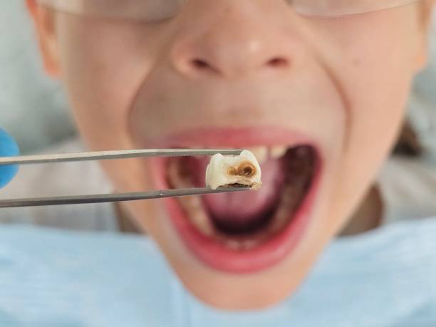 Best Emergency Treatment for Toothache in Altamont, TN